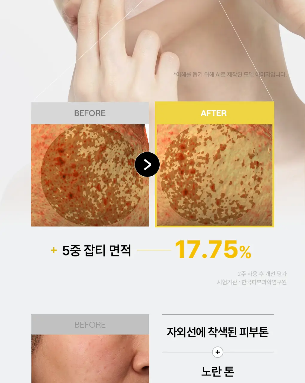 [76관왕 No.1] 메디힐 더마 패드 100매 7종 피부 고민별 골라담기 상세페이지 42